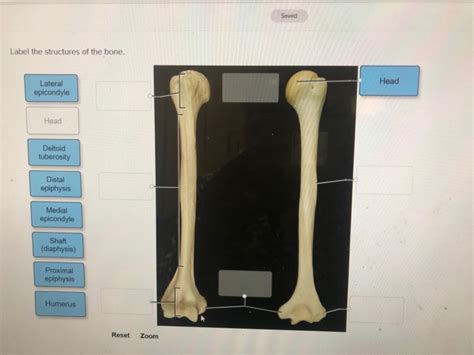 Solved Saved Label The Structures Of The Bone Head Lateral Chegg