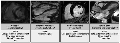 Practical Guide To Evaluating Myocardial Disease By Cardiac Mri Ajr