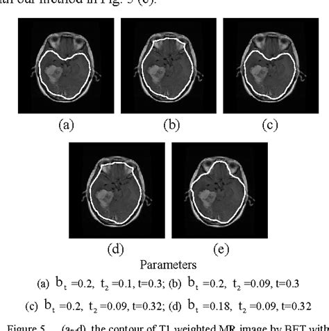 Figure From Automatic Extraction Of Brain From Cerebral Mr Image