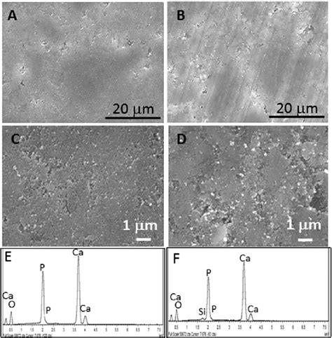 Scanning electron micrographs (magnification Â 2000) obtained from ...