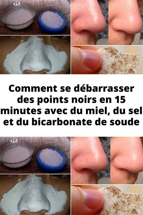 Comment se débarrasser des points noirs en 15 minutes avec du miel du