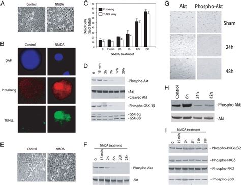 Akt ͞ PKB kinase activity decreases during neuronal cell death. ( A–D ...