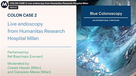 Cesare Hassan Endoscopy On Air