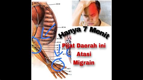 Sering Sakit Kepala Dan Migrain Jangan Cemas Kombinasi Beberapa Titik