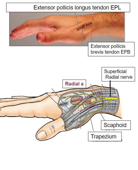 Anatomical Snuff Box Diagram | Quizlet