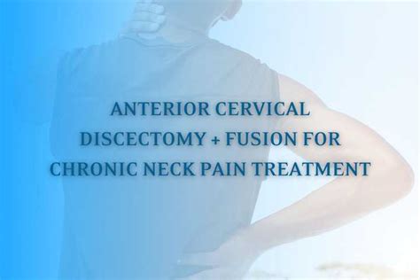 Anterior Cervical Discectomy And Fusion For Treating Chronic Neck Pain