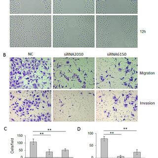 Knockdown Of Notch Inhibits The Migration And Invasion Abilities Of