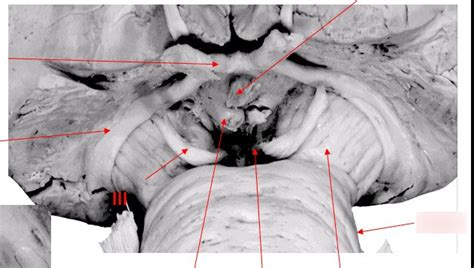 Anterior Midbrain Diagram Quizlet