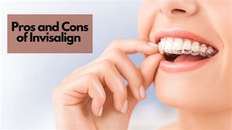 Pros And Cons Of Invisalign Beautiful Smiles Dental Center