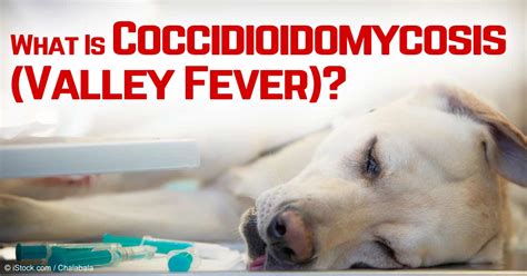 Coccidiomycosis Titer