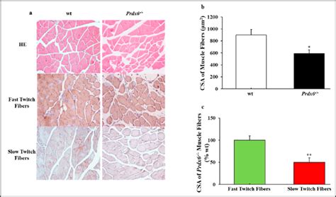 Muscle Atrophy Histology