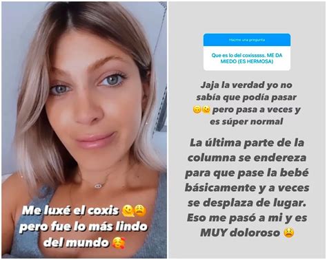 El relato de Cande Ruggeri sobre su parto Me luxé el coxis pero fue