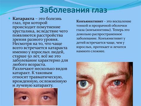 Инфекции глаз человека: какие заболевания к ним относятся, чем лечатся