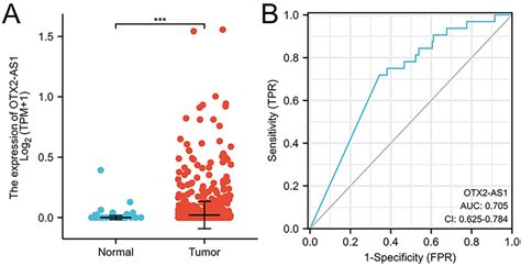 Relationship Between Otx2 As1 Expression And Clinical Features Of Gc