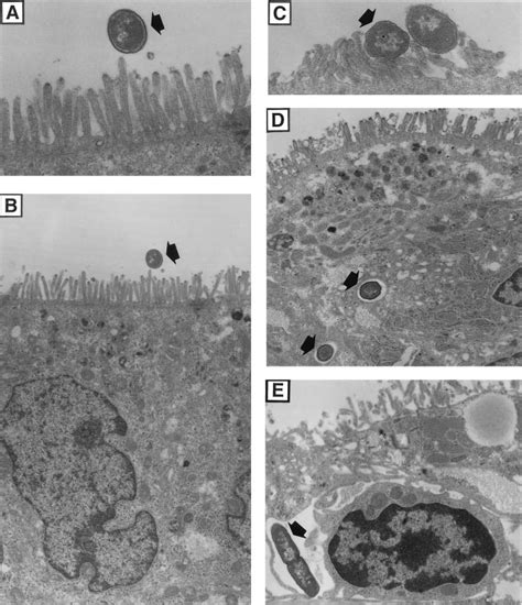 Vibrio cholerae binding , internalization, and translocation. Vibrio ...