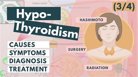 Hypothyroidism Causes Symptoms Diagnosis Treatment Visual