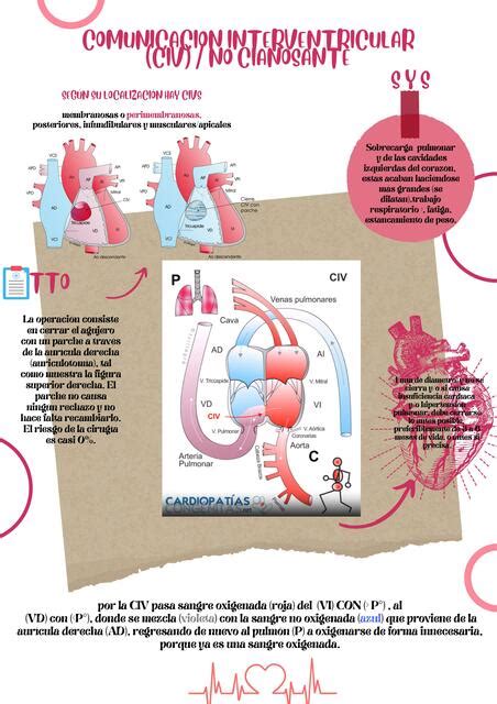 Comunicación Interventricular Marisol Erazo uDocz