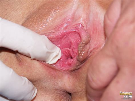 Gyno Exams 2 0613 Porn Pic