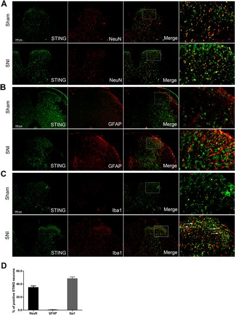 Expression And Cellular Localization Of Sting In Spinal Cord Dorsal