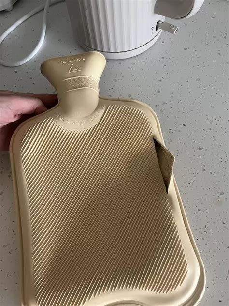 Woman Burnt Alive As Hot Water Bottle Suddenly Explodes All Over Her Bare Skin The Mirror