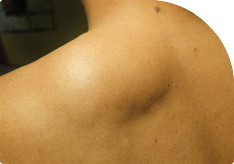 Soft Tissue Ultrasound | Saddletown Ultrasound | NE Calgary