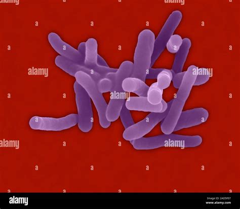 Coloured Scanning Electron Micrograph SEM Of Shigella Sonnei Gram