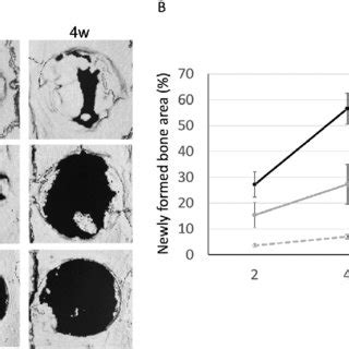 Micro CT Evaluation Of Bone Formation Following Implantation Of MSC CM