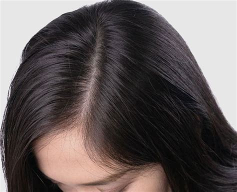 Healthy Tips To Take Care Of Your Hair Scalp Herzindagi