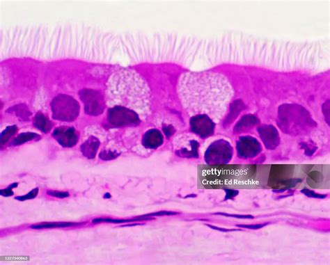 Ciliated Epithelium Lining The Tracheapseudostratified Ciliated