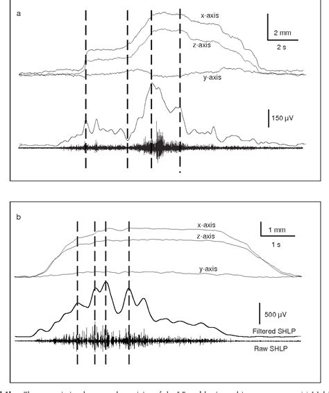 Structure Of Lateral Pterygoid Muscle Semantic Scholar
