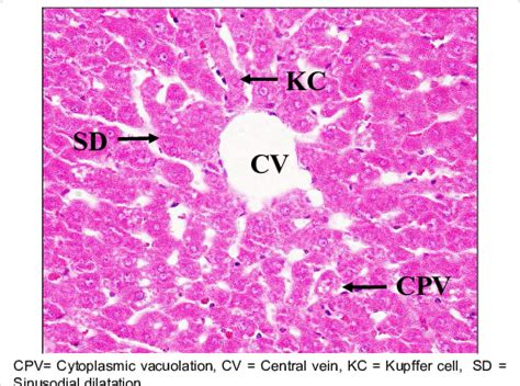 Histologic Section Of Liver Tissue Section Stained With Hande X400