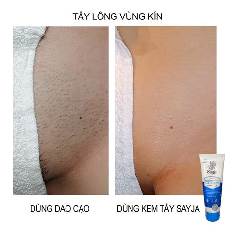 Mua Kem T Y L Ng Sayja Tri T L Ng V Ng K N Bikini Ch N Tay N Ch R U Dung T Ch Ml