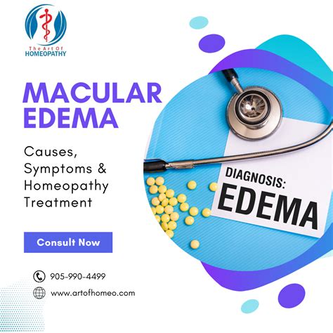 Macular Edema: Causes, Symptoms & Homeopathy Treatment - Art Of Homeopathy