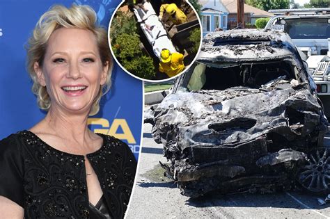 Anne Heche Remains In Coma After Fiery Crashing Into House