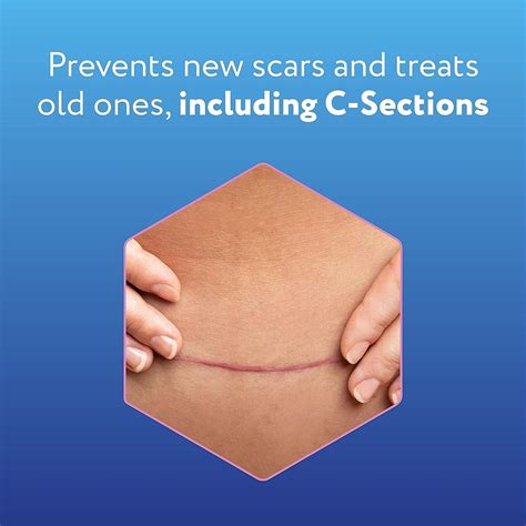 ScarAway Advanced Skincare Silicone Scar Sheets For C Section Reusable