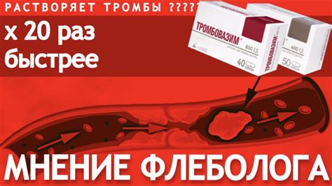 Это средство растворяет тромбы? Мнение флеболога. - YouTube