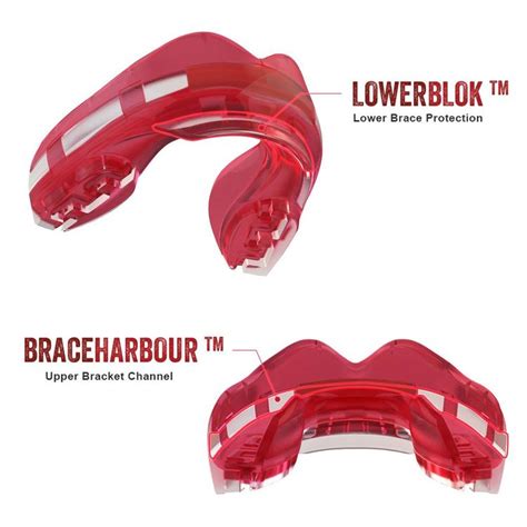 Капа одночелюстная для брекетов Safe Jawz Ortho Series (SJOSSF-Ice-Pink ...