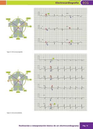 Manual Electrocardiografía ECG AMIR