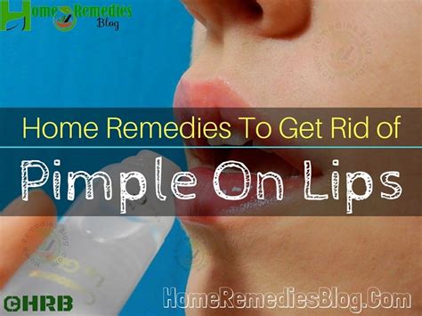 15 Home Remedies to Get Rid of Pimple on Lip Naturally - Home Remedies Blog