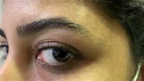 perform  horizontal gaze nystagmus hgn public