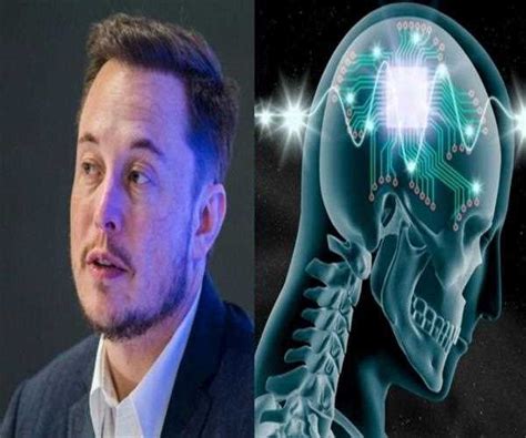 What does Elon Musk Neuralink is all about - MindStick YourViews