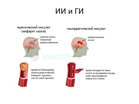 Основные вопросы поликлинической неврологии - презентация онлайн