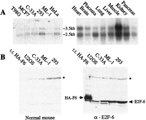 E2F-6, a member of the E2F family that can behave as a transcriptional ... 