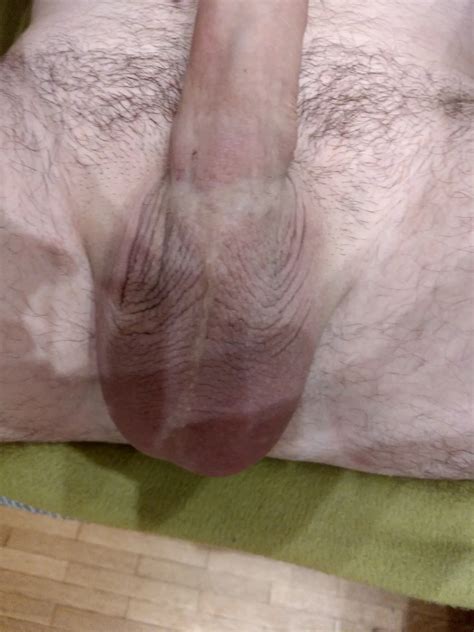 Extreme Cock Banding 10 Nude Pics XHamster