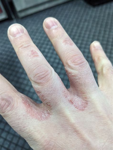 Озеро достатка на большом пальце руки значение фото