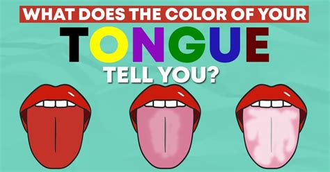 What Does The Color Of Your Tongue Mean Williams Integracare Clinic