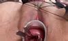 Extreme Cervix Queen Long Hair Hd Porn Video Fe Xhamster