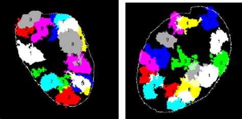 2D segmented sections of chromosome territory in cell nucleus images ...