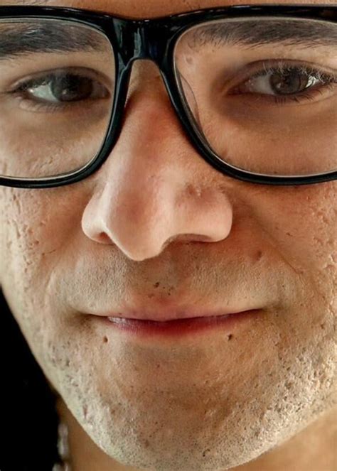 Celebrities With Acne Scars Racnescars
