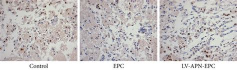 TUNEL staining was used to detect the cell apoptosis of every group ...